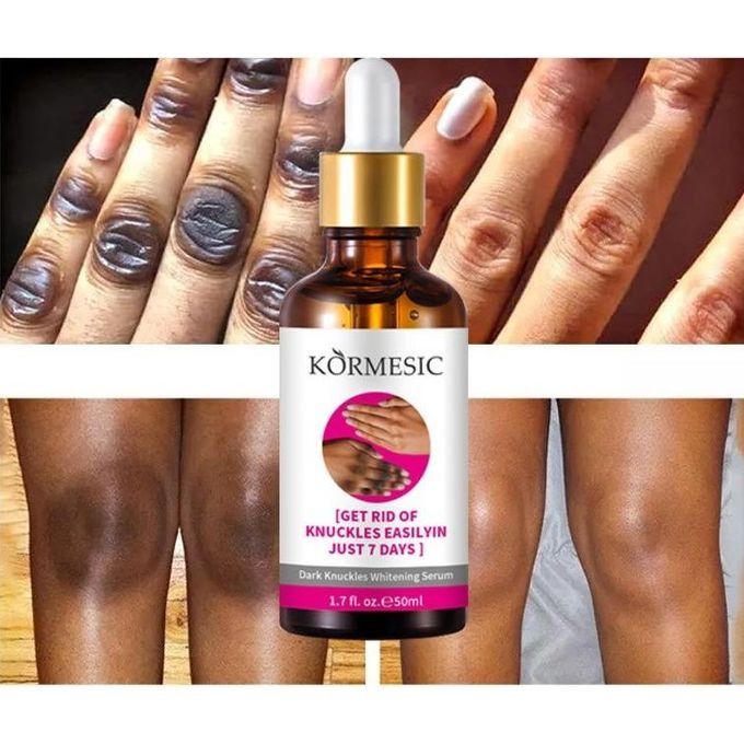 Authentic Strong Whitening Serum for Dark Skin Lightening Lotion for Dark Knuckles, Elbows, Fingers and Inner Thighs - KORMESIC -