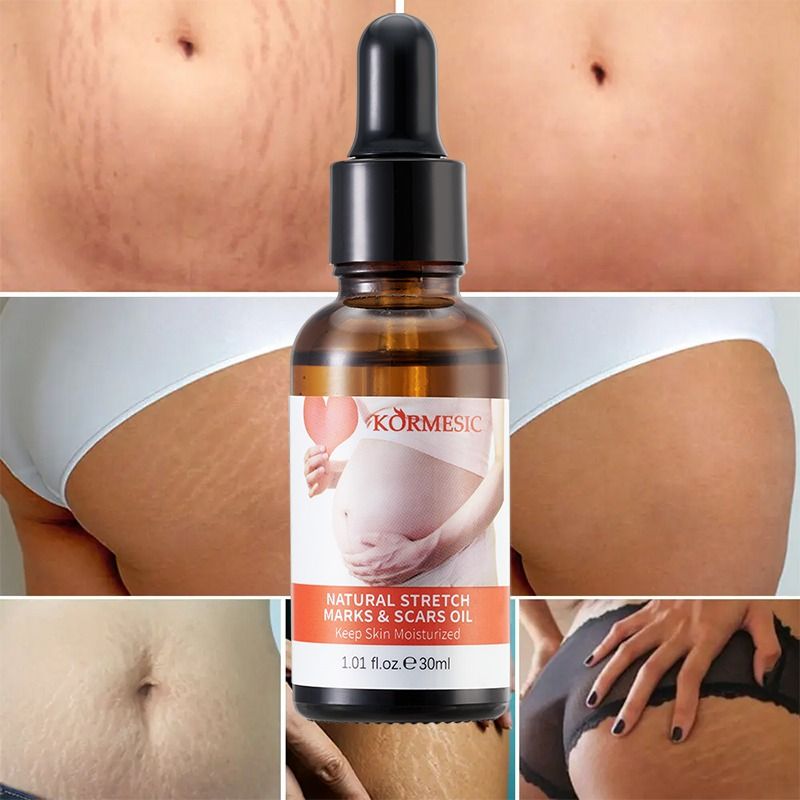Stretch Marks Permanent Removal Oil Eliminate Body Belly Stretch Marks Swelling Marks Stretch Mark Remover Skin Cracks Repair Firming Care Anti-Aging Anti-Winkles Increase Elasticity - KORMESIC -