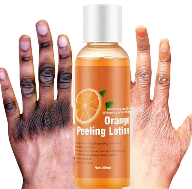 Peeling Lotion For Dark Skin Lightening Whitening Black Skin Orange Peeling Essential Lotion Strong Peeling Oil For Skin Brightening Moisturizing 100ml Gentle Exfoliating Blackhead Remover -