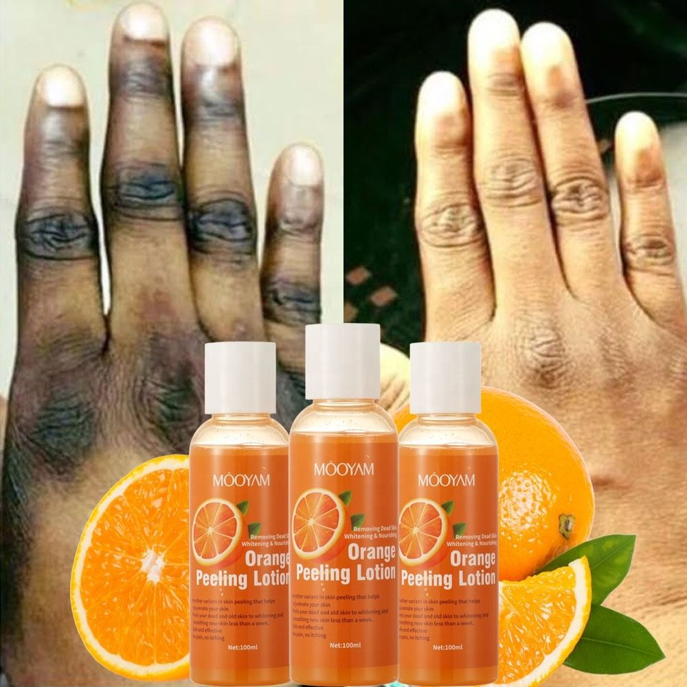 Black Skin Whitening Dark Spots Knuckles Remover Orange Peeling Lotion Oil 100% Organic Bleaching Dark Skin Exfoliating Whitening Nourishing Moisturizing Body Scrub Brightening Peeling Gel for Skin-
