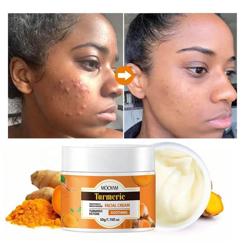 Turmeric Face Cream for Dark Spots – Natural Turmeric Skin Brightening Lotion for Face & Body – Cleanse Skin, Fight Acne, Even Tone, Clear Scars, Sun Damage, & Hyperpigmentation – 50g -MOOYAM-