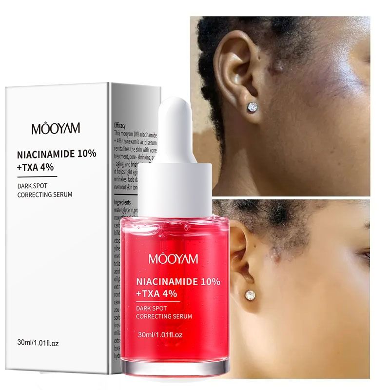 Niacinamide 10% + TXA 4% for Dark Spots, Hyperpigmentation, Uneven Tone, Dark Spot Corrector, Hydrating, Brightening and Clarifying Facial Serum for Smooth, Radiant Looking Skin - MOOYAM -