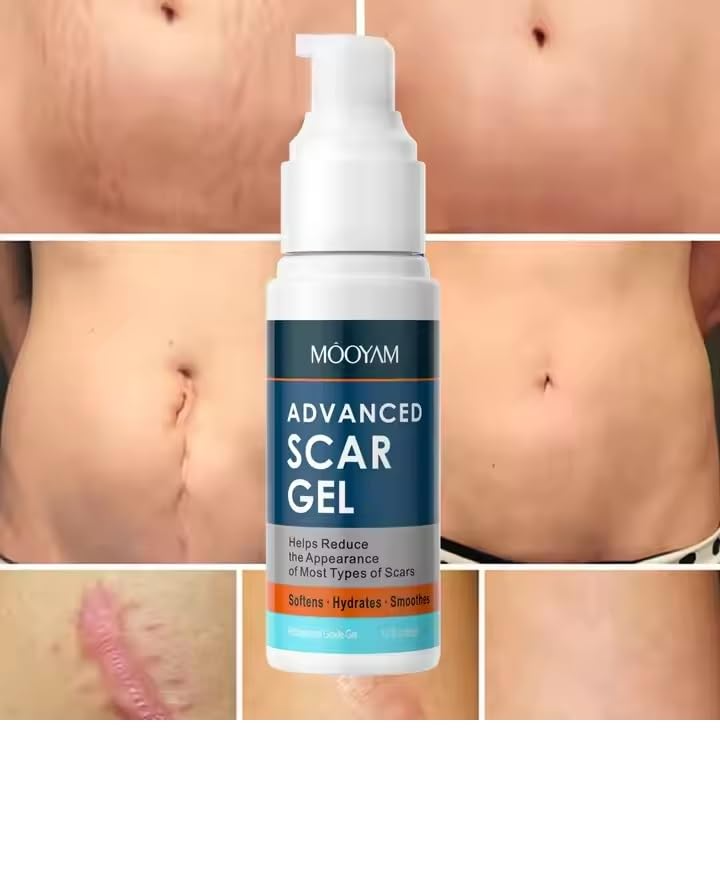 Silicone Scar Gel Scar Cream, Treats Old and New Scars, Stretch Marks Removal Formula Helps from Surgical, Burns, Acne Scar Treatment with Advanced Scar Gel - MOOYAM-