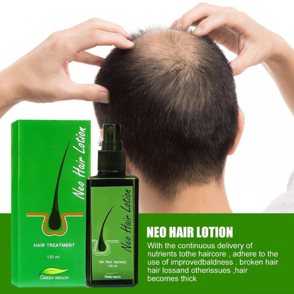 Green Wealth Neo Hair Lotion Hair Treatment Herbs -100% Natural Hair Growth Treatment-120mL + (Free Derma Roller For Hair Growth)