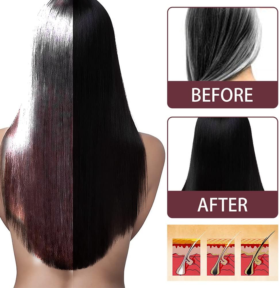 South Moon Herbal (Polygonum Multiflorum, Ginger, Ganoderma & Ginseng) White to Black Hair Serum, Nourishes and Restores Hair’s Natural Color, Anti-Grey Hair Serum Spray for Reducing Grey Hair-100ml.