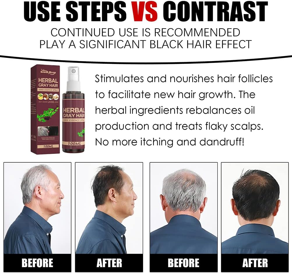 South Moon Herbal (Polygonum Multiflorum, Ginger, Ganoderma & Ginseng) White to Black Hair Serum, Nourishes and Restores Hair’s Natural Color, Anti-Grey Hair Serum Spray for Reducing Grey Hair-100ml.