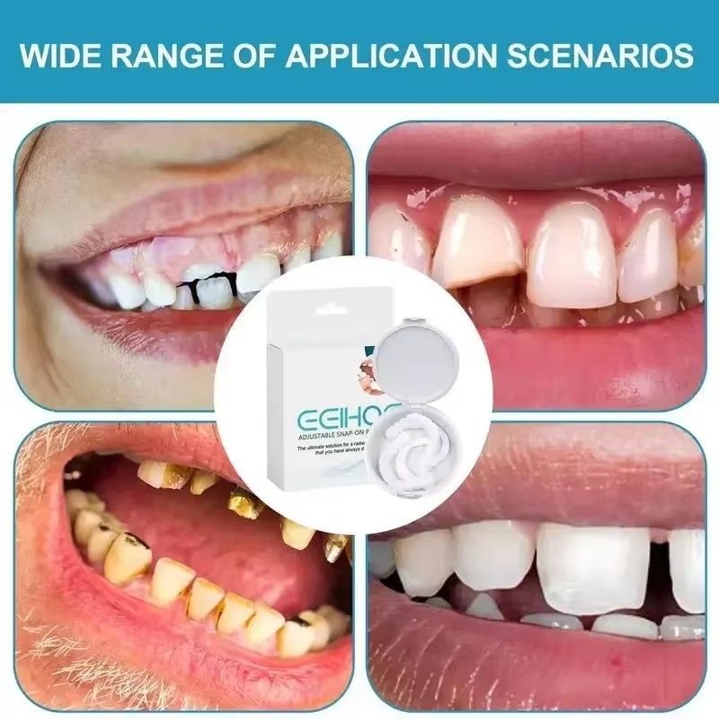 Perfect Fit Teeth Whitening Fake Tooth Cover Snap On Silicone Smile Veneers Teeth Upper Beauty Tool Reusable Cosmetic Teeth