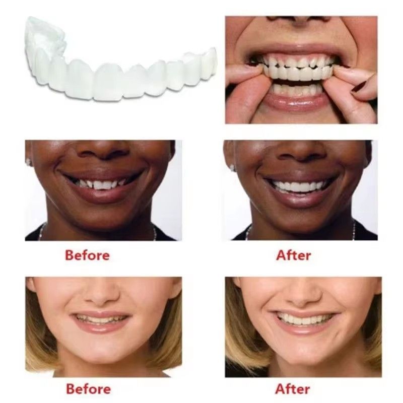 Perfect Fit Teeth Whitening Fake Tooth Cover Snap On Silicone Smile Veneers Teeth Upper Beauty Tool Reusable Cosmetic Teeth
