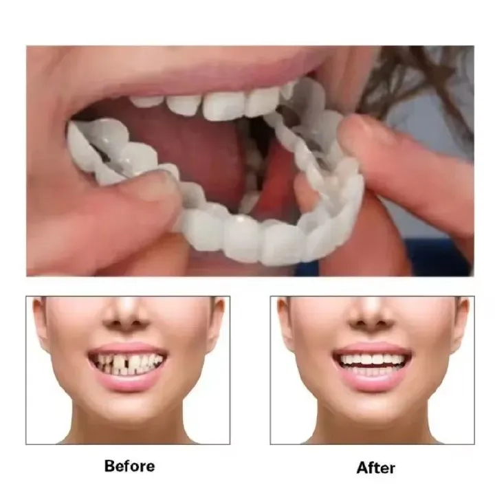 Perfect Fit Teeth Whitening Fake Tooth Cover Snap On Silicone Smile Veneers Teeth Upper Beauty Tool Reusable Cosmetic Teeth