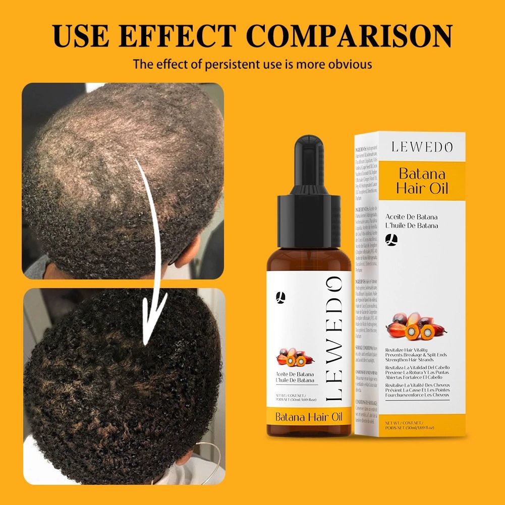 Fast Hair Growth Oil + Cream Africa Crazy Traction Alopecia batana Hair Mask Anti Hair Break Hair Strengthener Hair Loss Treatment Spray Upgrade to the larger-capacity version