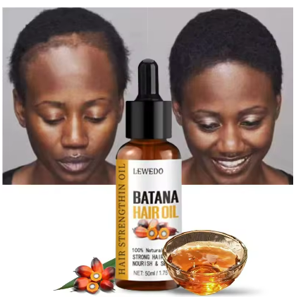 Fast Hair Growth Oil + Cream Africa Crazy Traction Alopecia batana Hair Mask Anti Hair Break Hair Strengthener Hair Loss Treatment Spray Upgrade to the larger-capacity version