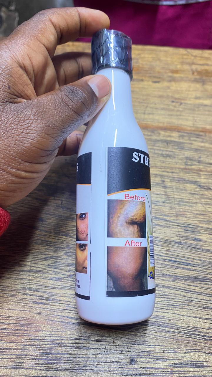 Stretch Marks and Scars Vanishing Lotion with Goat Milk 200g