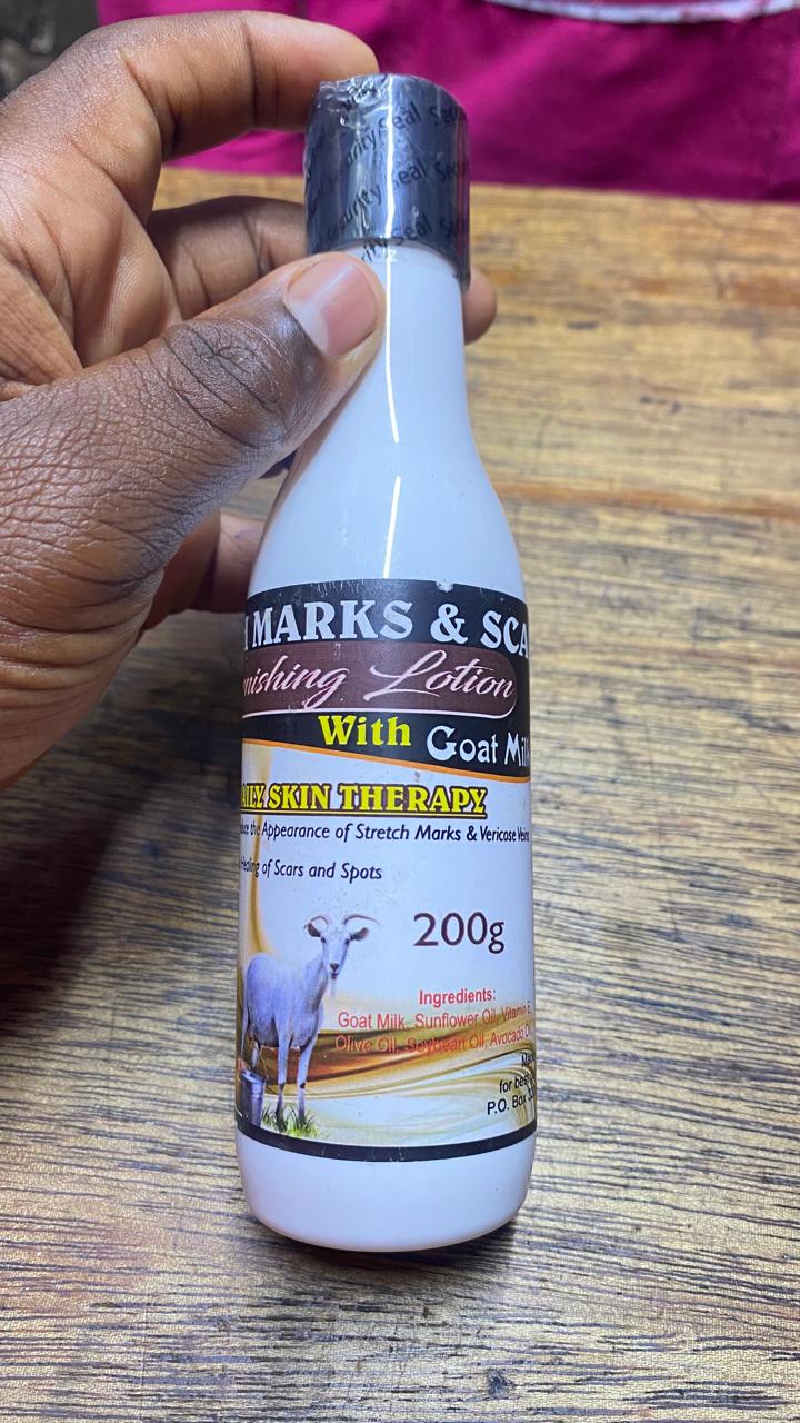 Stretch Marks and Scars Vanishing Lotion with Goat Milk 200g