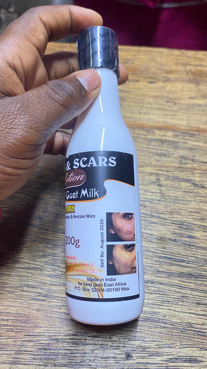 Stretch Marks and Scars Vanishing Lotion with Goat Milk 200g