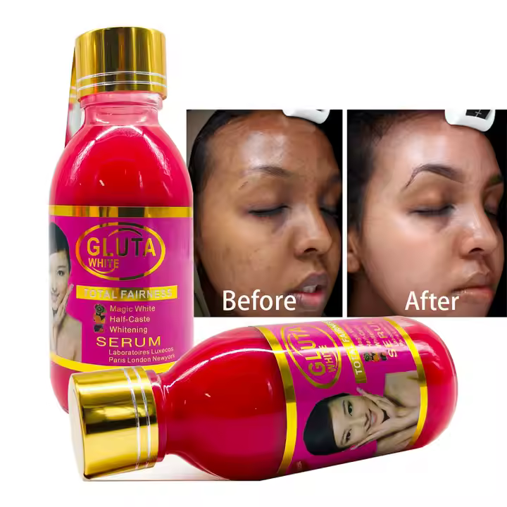 Gluta White Total Fairness Magical White Half Cast Whitening Serum Moisturize Skin Remove Pimple 125ml