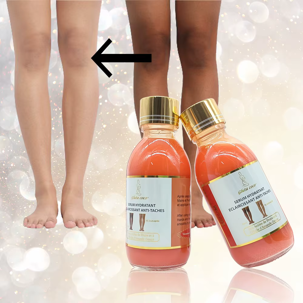Gluta Coco Anti-Taches And Whitening Skin Care Beauty Products Facial Body Serum 125ml Can Mix with Lotion