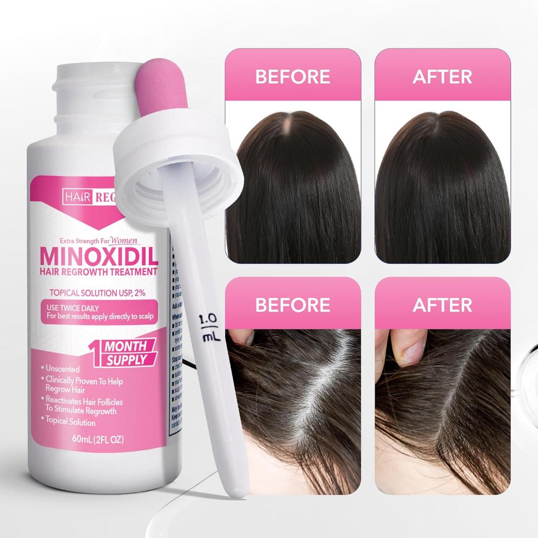 Regen Oil Hair Advanced 2% Minoxidil For Women, Hair Regrowth Treatment For Thinning Hair, Hair Loss For Women,1 Month Supply, Minoxidil Topical Solution For Thicker Fuller Hair
