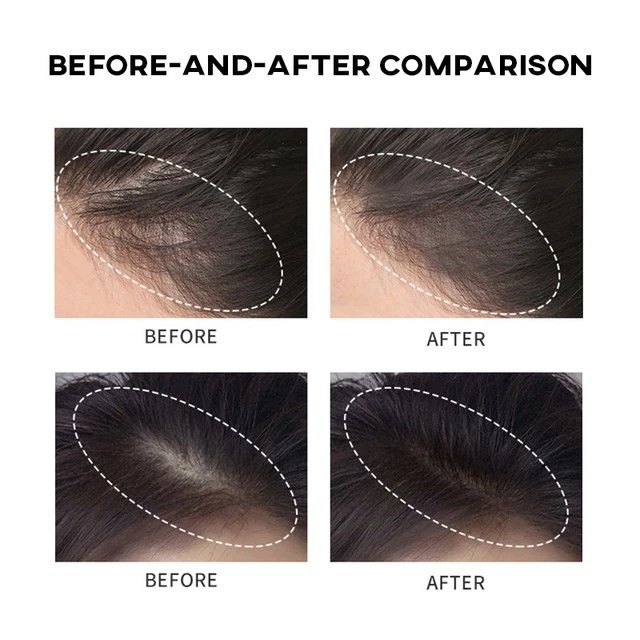 Hair Line Dye Powder Black & Brown – Natural Instant Root Cover Up, Waterproof Hairline Shadow Powder & Scalp Concealer for Thinning & Bald Spots.