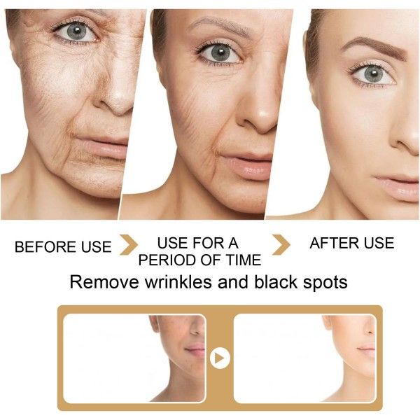 Moisturize Face Lighten Skin Lift Wrinkles Soothe And Shrink Pores Essential Oil  Creams & Moisturizers