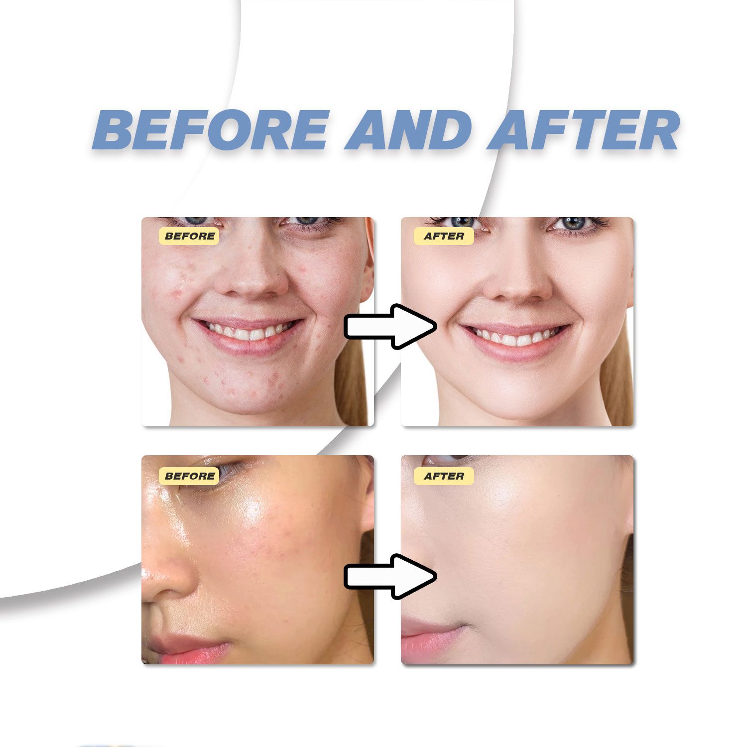 Lady Nian Dichloroacetate Cream 30g - Anti-Bacterial And Anti-Acne Skin Care Product