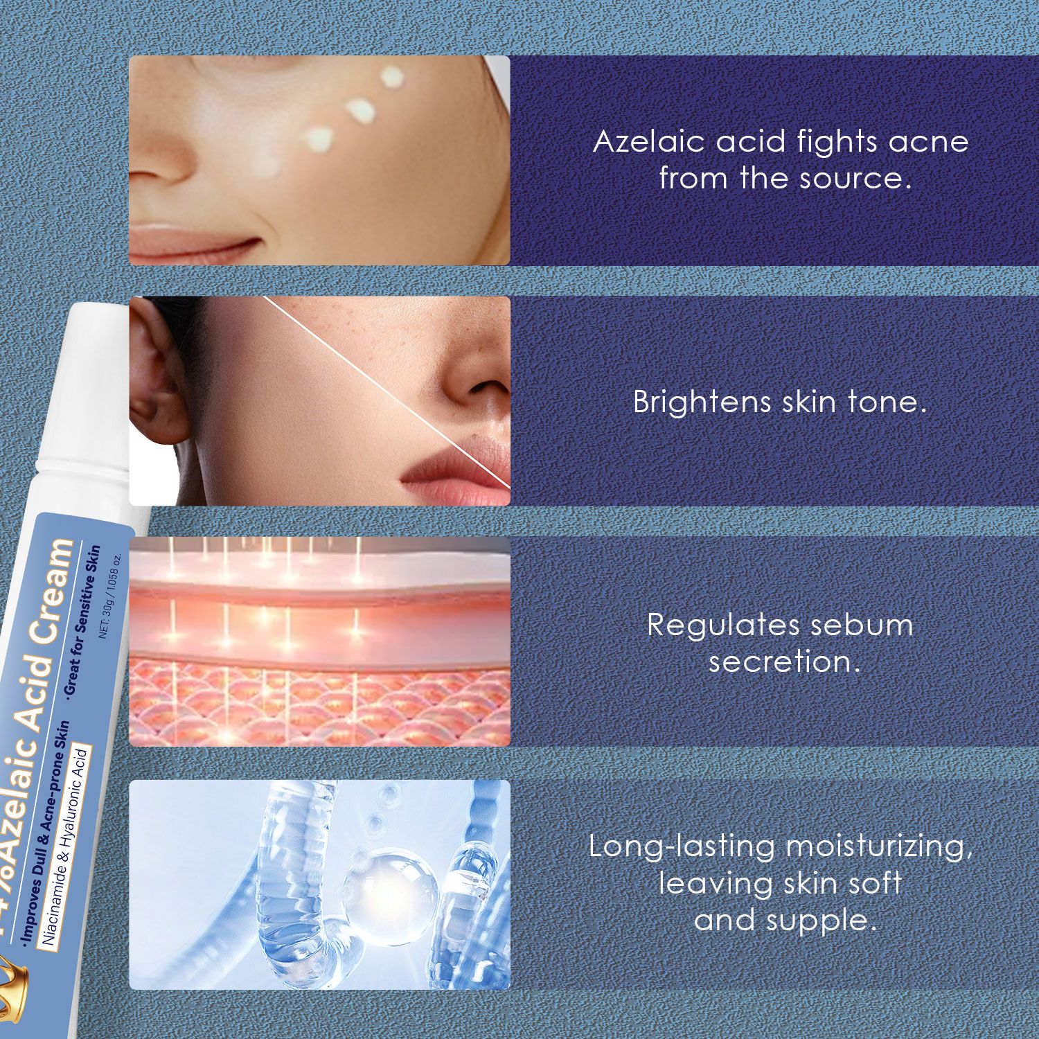 Lady Nian Dichloroacetate Cream 30g - Anti-Bacterial And Anti-Acne Skin Care Product