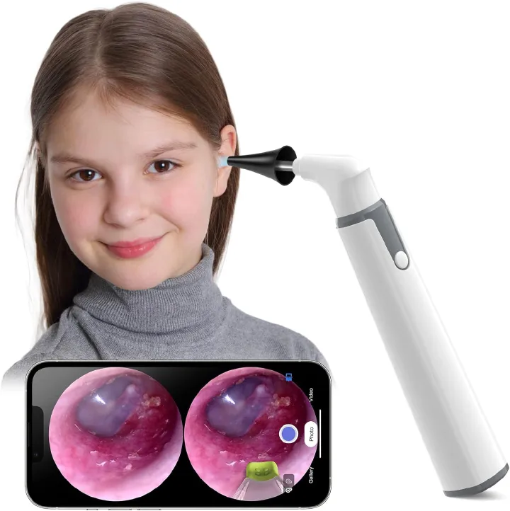 Wireless Otoscope Ear Camera Ear Wax Removal Kit Camera with 6 LED Lights 3.9mm Visual Ear Scope for Kids, Adults & Pets, Compatible with Android/iPhone/iPad