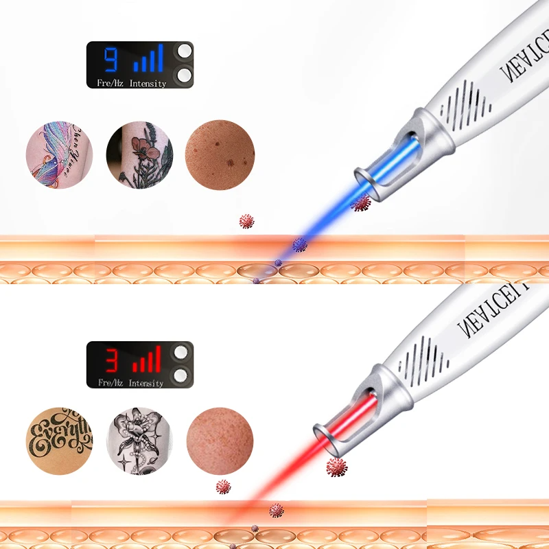 Red And Blue Light Laser Picosecond Pen To Remove Dark Spots Tattoo Skin Pigment Plasma Pen Portable Skin Care Beauty Instrument
