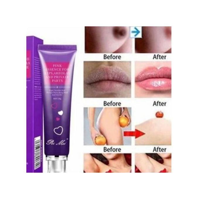 Pei Mei Pink Essence Cream – Brightening & Moisturizing Cream For Lips, Areolas, And Intimate Areas