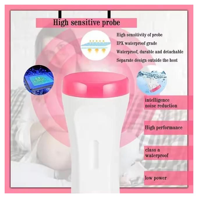 HANDHELD FETAL DOPPLER, BABY HEARTBEAT MONITOR, OR PRENATAL DOPPLER DEVICE, PARTICULARLY IN MEDICAL AND MATERNITY CARE