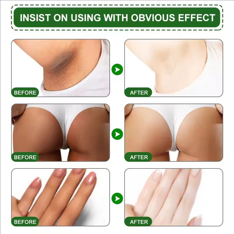 Body Whitening Cream Private Parts Underarm Bleaching Serum Whiten Butt Knee Brighten Inner Thigh Intimate Crema blanqueadora