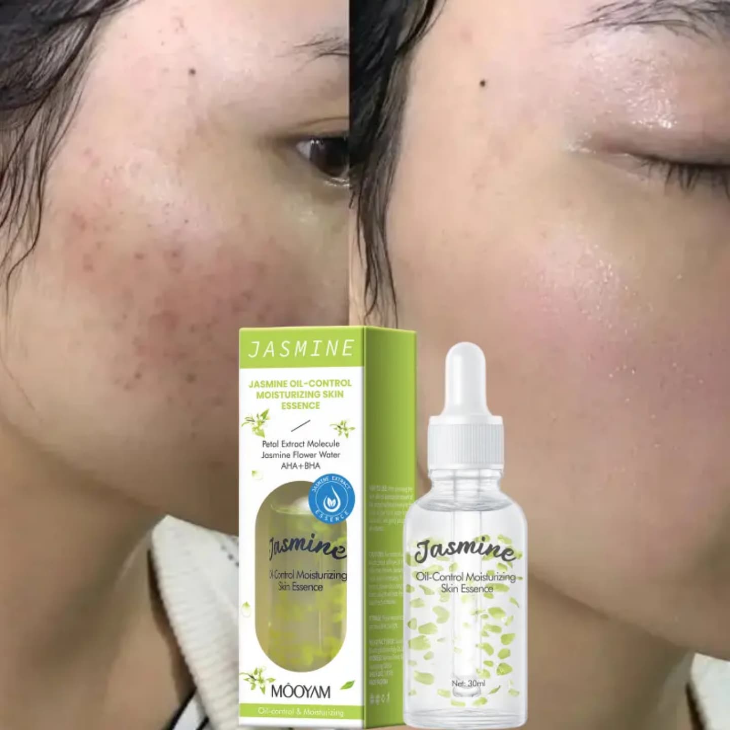 [OFFER] MÔOYAM Jasmine Oil-Control Moisturizing Essence – AHA + BHA Skin Refiner – Pore Minimizing & Hydrating Glow Serum (30ml)