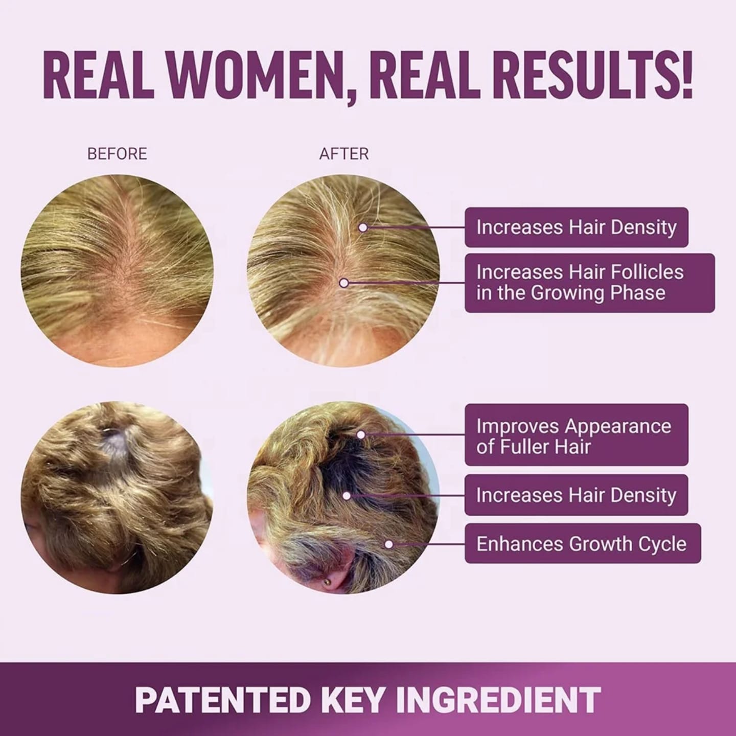 New Hair Growth Accelerator Chews – Boosts Hair Growth & Thickness, Reduces Hair Loss, Strengthens Roots, Nourishes Scalp, Adds Shine, Supports Healthy Hair, Skin & Nails, and Promotes Natural Volume