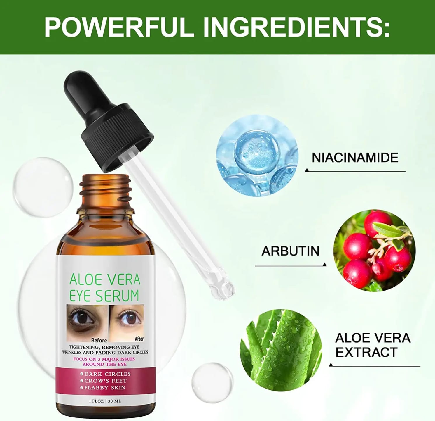 Mooyam Aloe Vera Dark Circle Removal Serum – Reduces Eye Bags & Puffiness, Brightens Under Eyes, Fades Wrinkles & Fine Lines, Soothes Tired Skin, Hydrates, and Restores Firm, Youthful Eye Area