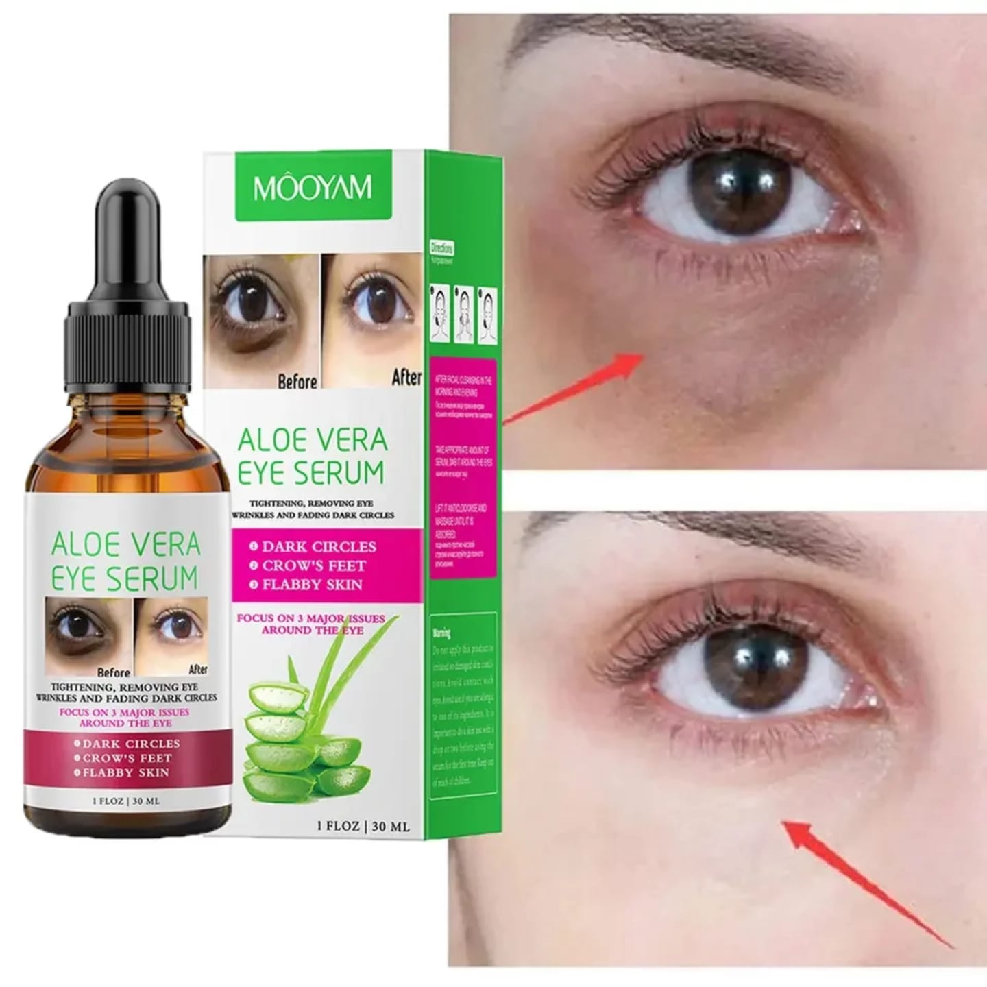 Mooyam Aloe Vera Dark Circle Removal Serum – Reduces Eye Bags & Puffiness, Brightens Under Eyes, Fades Wrinkles & Fine Lines, Soothes Tired Skin, Hydrates, and Restores Firm, Youthful Eye Area