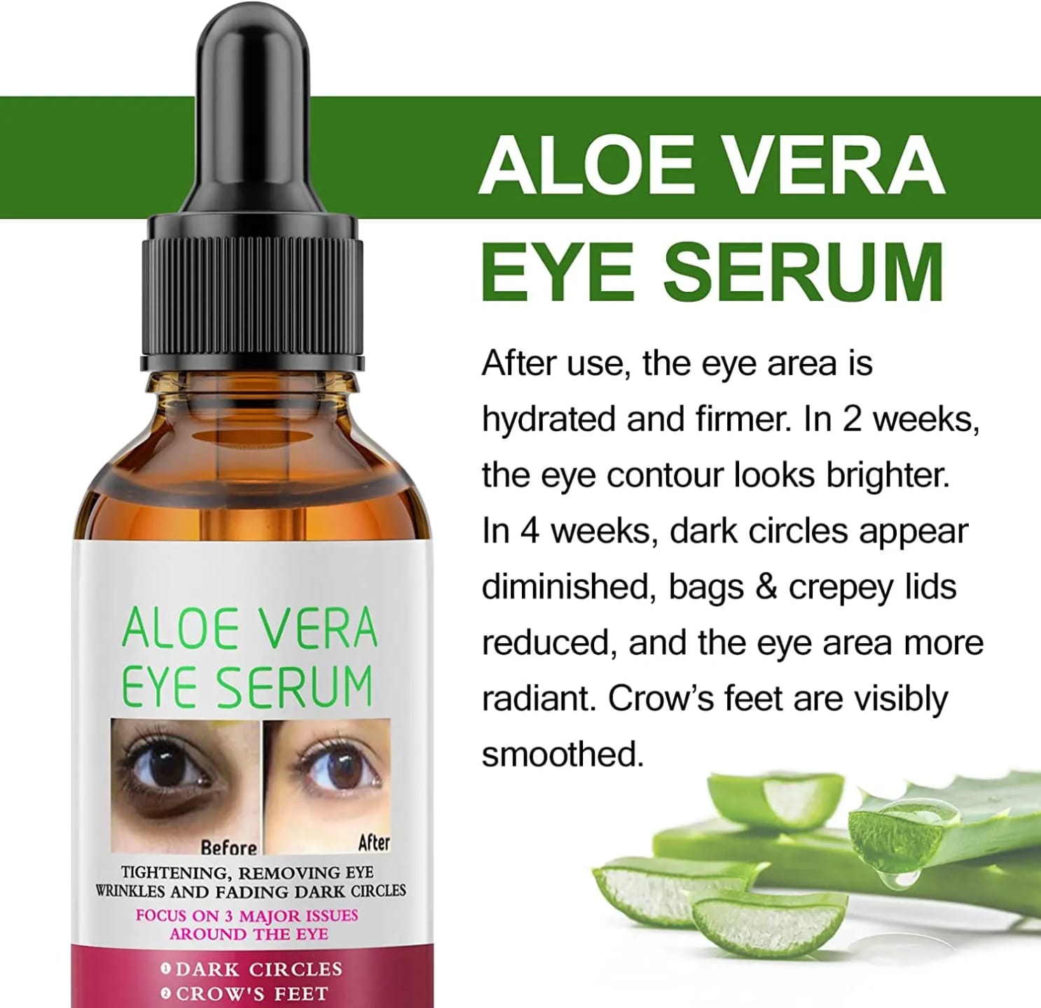 Mooyam Aloe Vera Dark Circle Removal Serum – Reduces Eye Bags & Puffiness, Brightens Under Eyes, Fades Wrinkles & Fine Lines, Soothes Tired Skin, Hydrates, and Restores Firm, Youthful Eye Area