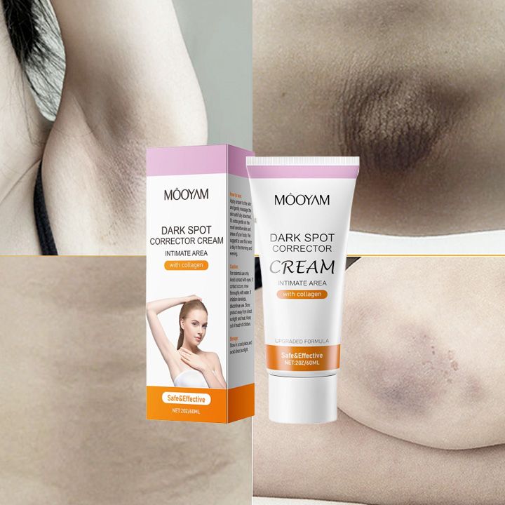 MOOYAM Intimate Dark Spot Corrector Cream with Collagen – Safe & Gentle for Sensitive Skin, 60ml
