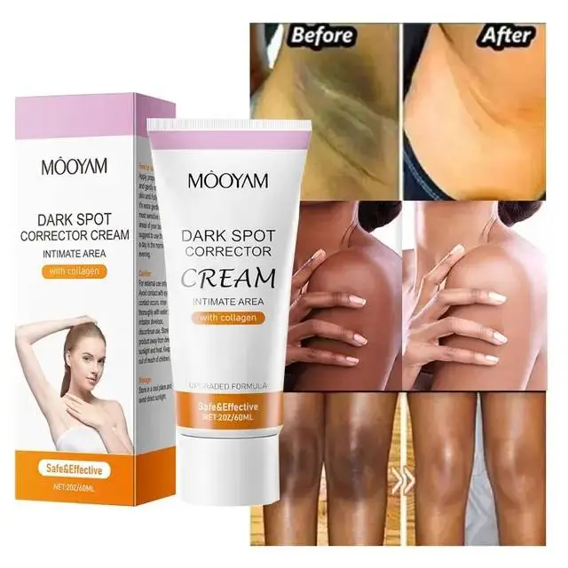 MOOYAM Intimate Dark Spot Corrector Cream with Collagen – Safe & Gentle for Sensitive Skin, 60ml