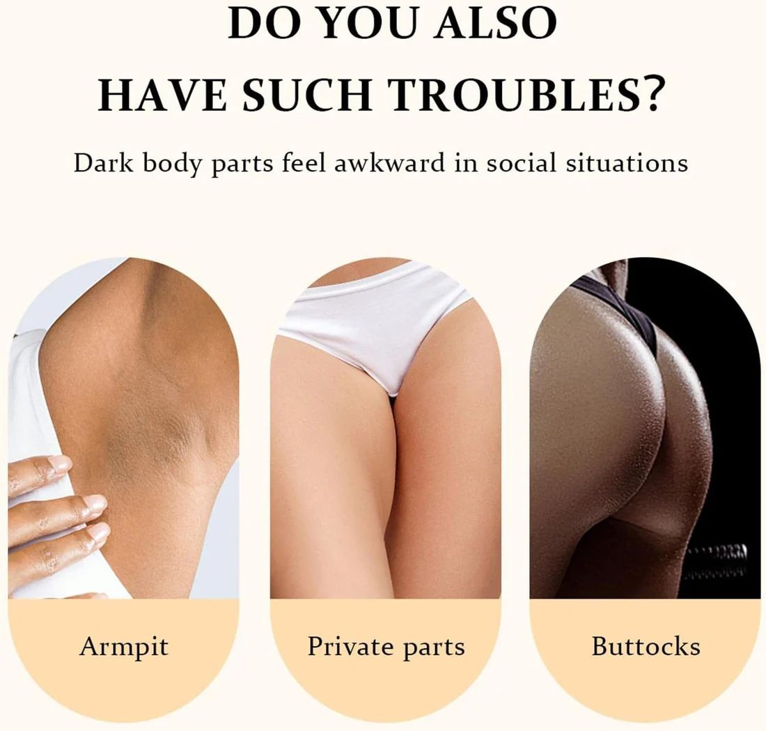 Inner Thighs Lightening Cream for Whitening Private Parts Brightening Skin Cream Dark Spots Eraser Body Bikini Area Cream  Mooyam