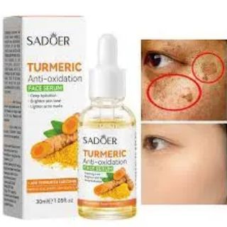 5 in 1 Sadoer Turmeric Set, Tumeric Cleanser + Face Serum +Face Toner + Face Cream + Tumeric Soap, with unparelled Vitamin C capabilities, Helps in Preven Acne, Sooth, Hydrate, Lighjten Acne Marks