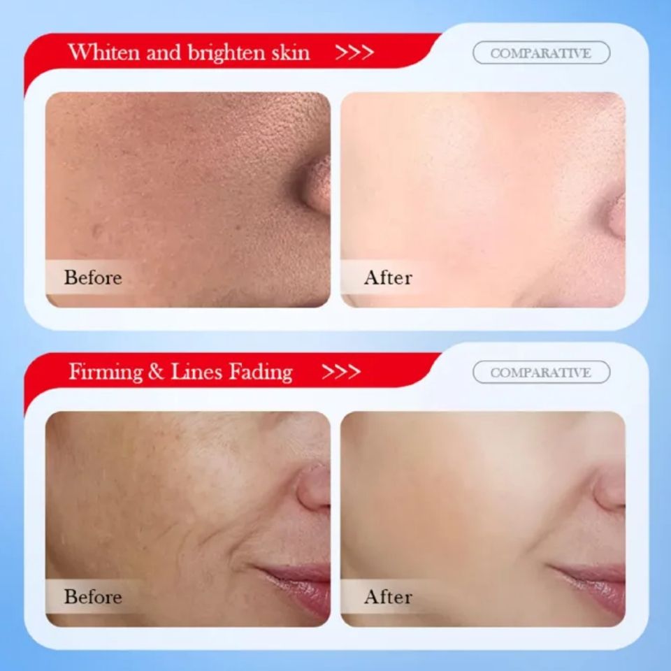 SADOER KOJIC ACID 30G WHITENING FRECKLE FACE CREAM WITH KOJIC ACID, NIACINAMIDE, HYALURONIC ACID, MOISTURIZES, FIRMS, ANTI-WRINKLE