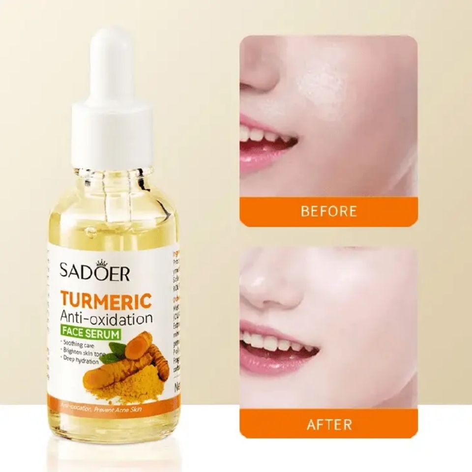Sadoer Duo Set of Tumeric Anti Oxidation Turmeric Soap Bar + Turmeric Serum Anti Acnes, Like Vitamin C, it is Effective in Acne Removal, Pore Shrinking and Skin Tone Brightening
