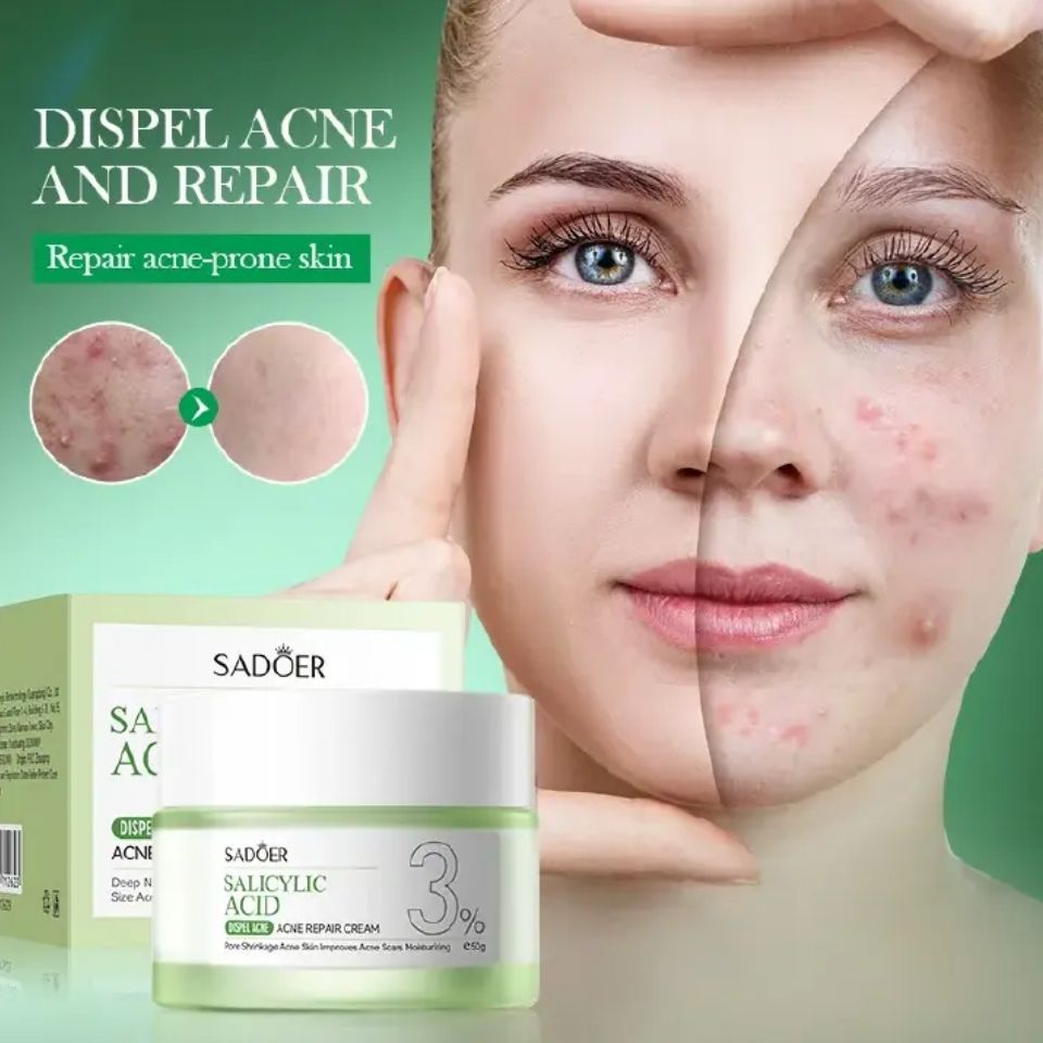 SADOER Acnes and Oil Control Cream, Salicylic acid Acnes, Oil Control Face Cream, Moisturizing, hydrating, Repair Acne Muscles,