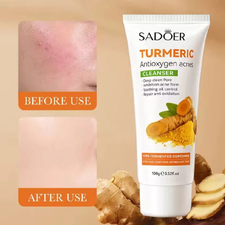 Sadoer Tumeric 3 in 1 Set, Turmeric Anti Acne Cleanser + Turmeric Face Serum + Tumeric Cream, Like Vitamin C, Guarantees Smooth Skin, Prevent Acnes, Control Oil, Remove Dark Spots , Moisturize, Refres