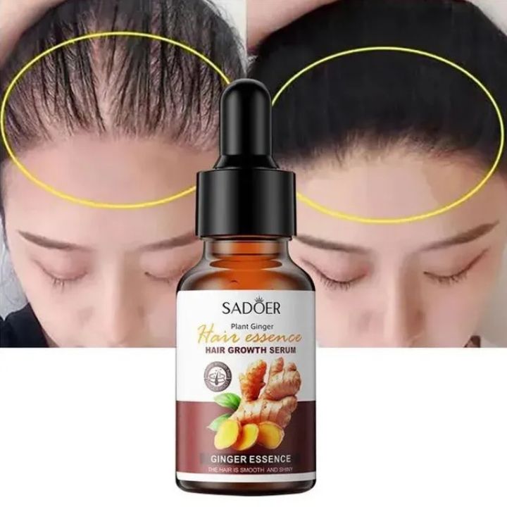 Sadoer Hair Care Serum, Ginger Hair Growth Based Product, Effective in Hair Growth,Moisturizing and Softening Forked Hair, with ScalpCare ingridients