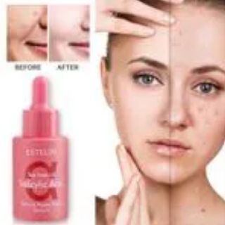 ESTELIN Salisylic Acid And Tea Tree Face Serum ,Removes Acnes Marks,Readiness, Control Oil And Sothes