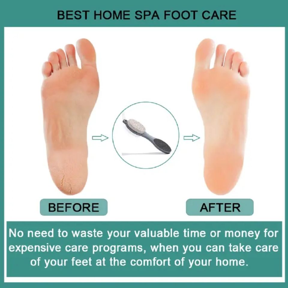 4 In 1 Foot Scraper Pedicure Tool Dead Skin Remover Scrubber Bush Pumice Stone File Heel Feet