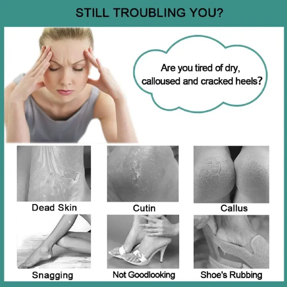 4 In 1 Foot Scraper Pedicure Tool Dead Skin Remover Scrubber Bush Pumice Stone File Heel Feet