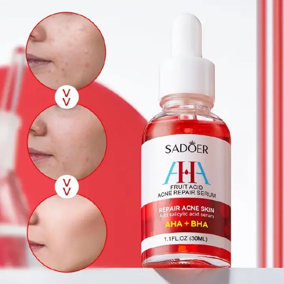 2 Pieces, Acne Repair Salicylic Acid AHA BHA Serum + Salicylic Acid Acne Treatment Essence Like Vitamin C, Face Moisturizing, Face Brightening, Anti wrinkles, Anti Aging, Removes acne, Treat Pimples