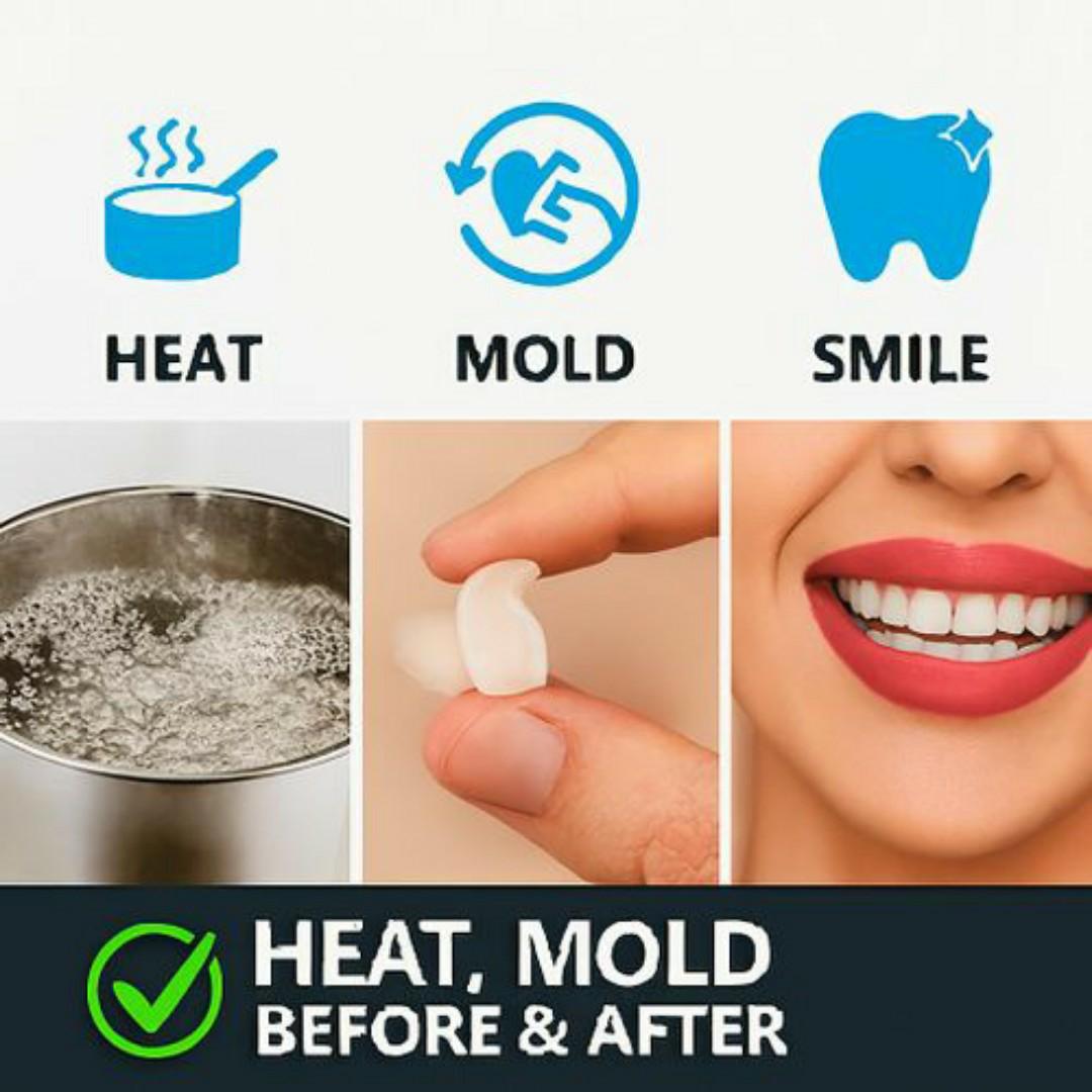 Eelhoe DIY Moldable False Teeth - 30ml Thermal Forming Temporary Tooth Replacement & Fillings - Instant Smile Repair - White Teeth