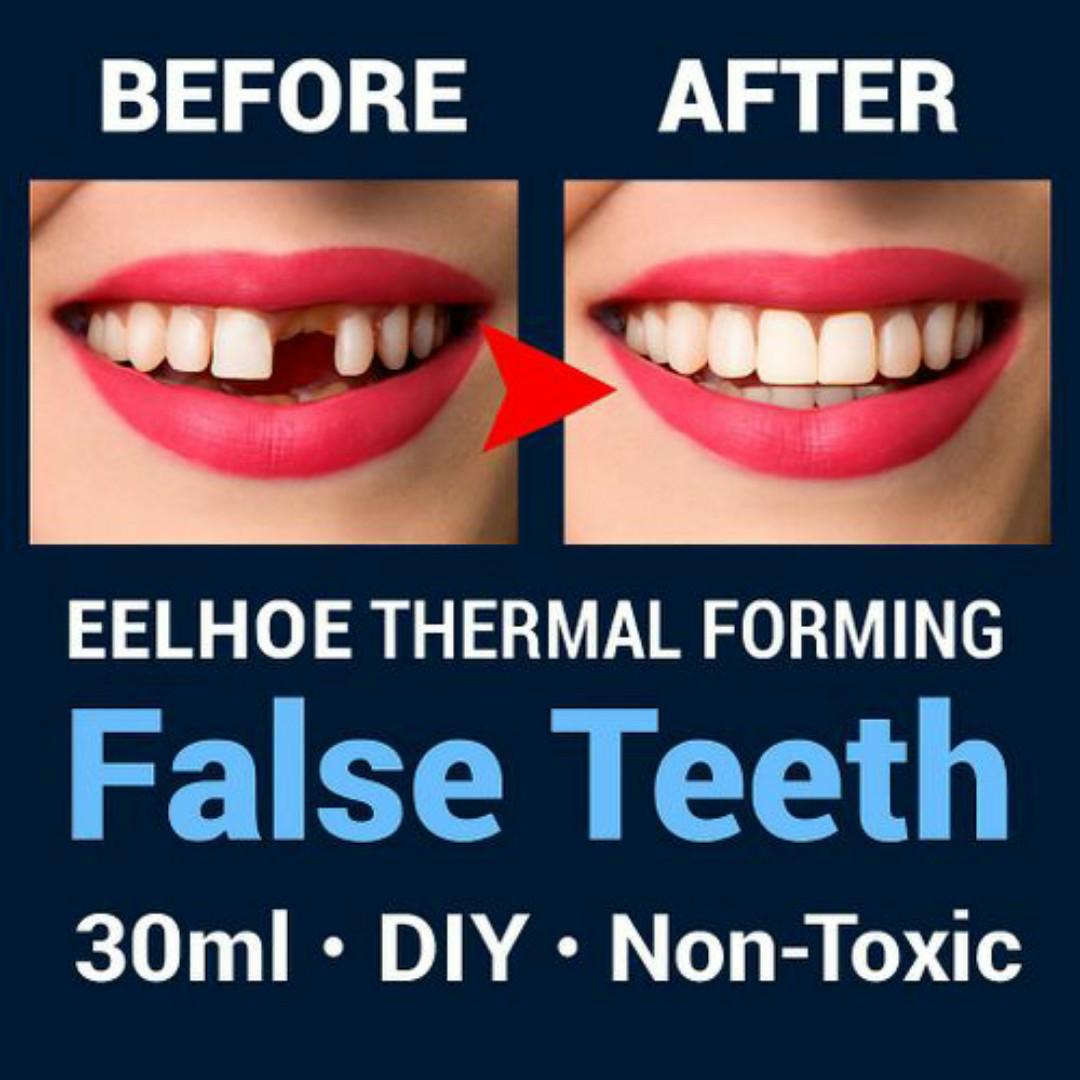 Eelhoe DIY Moldable False Teeth - 30ml Thermal Forming Temporary Tooth Replacement & Fillings - Instant Smile Repair - White Teeth